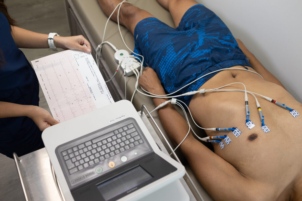 electrocardiography ecg e1678673700920
